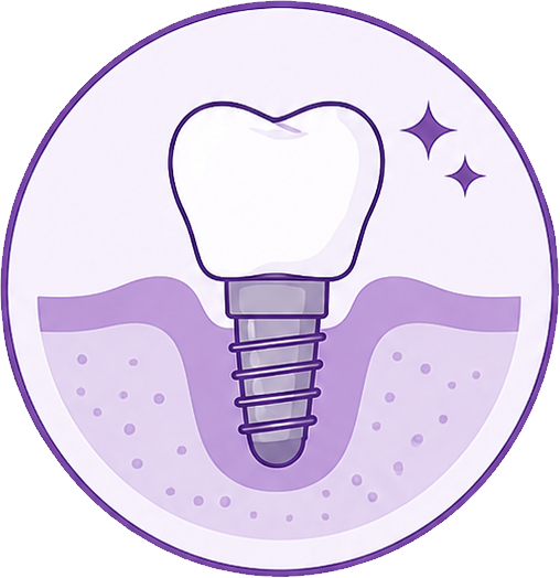 Ilustração de implante dentário